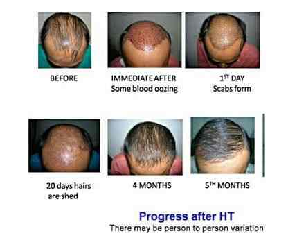 Lakshini Skin And Hair Centre Dermatologists Book Appointment