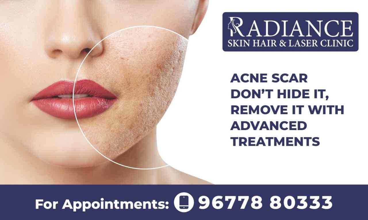 Details 132+ radiance skin and hair clinic POPPY