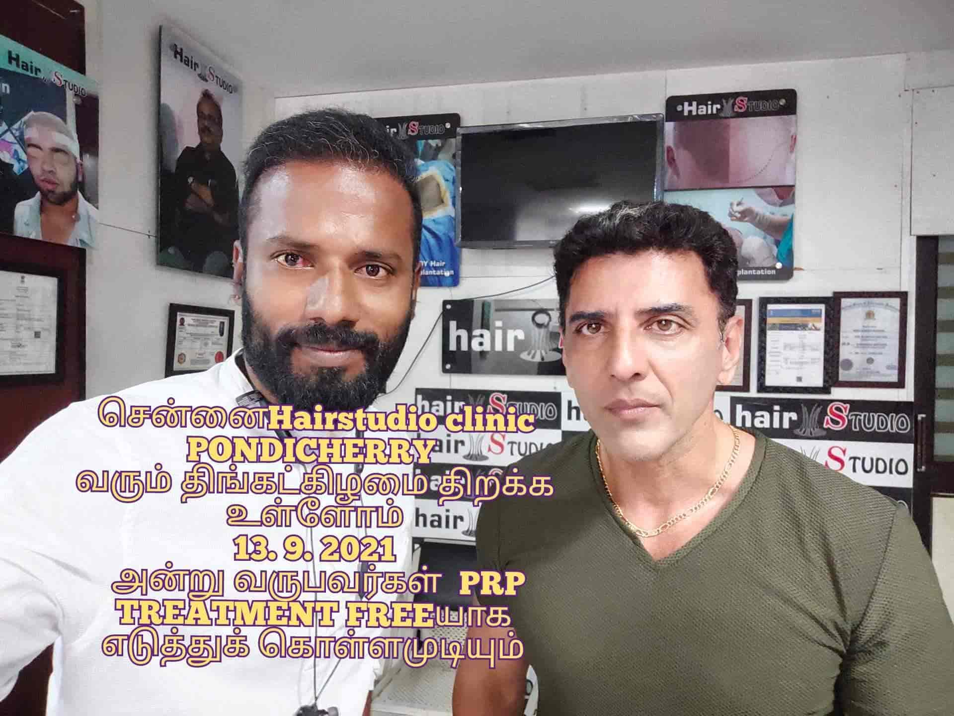 Share more than 144 hair fall treatment in chennai best camera.edu.vn
