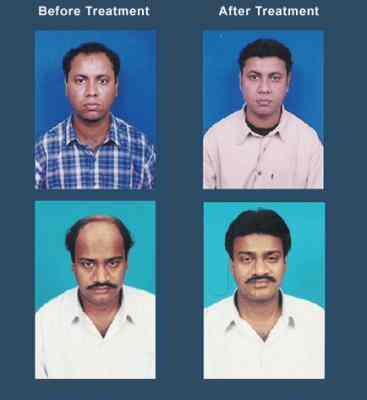 Pravin Hair Weaving Wigs Photos Bandra East Mumbai Pictures