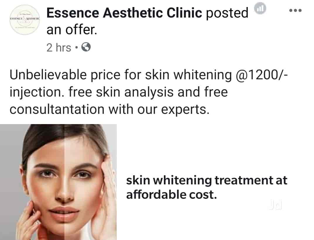 Discover 132+ hair transplant cost in vadodara POPPY