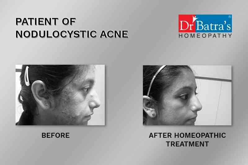 dr batra skin clinic near me