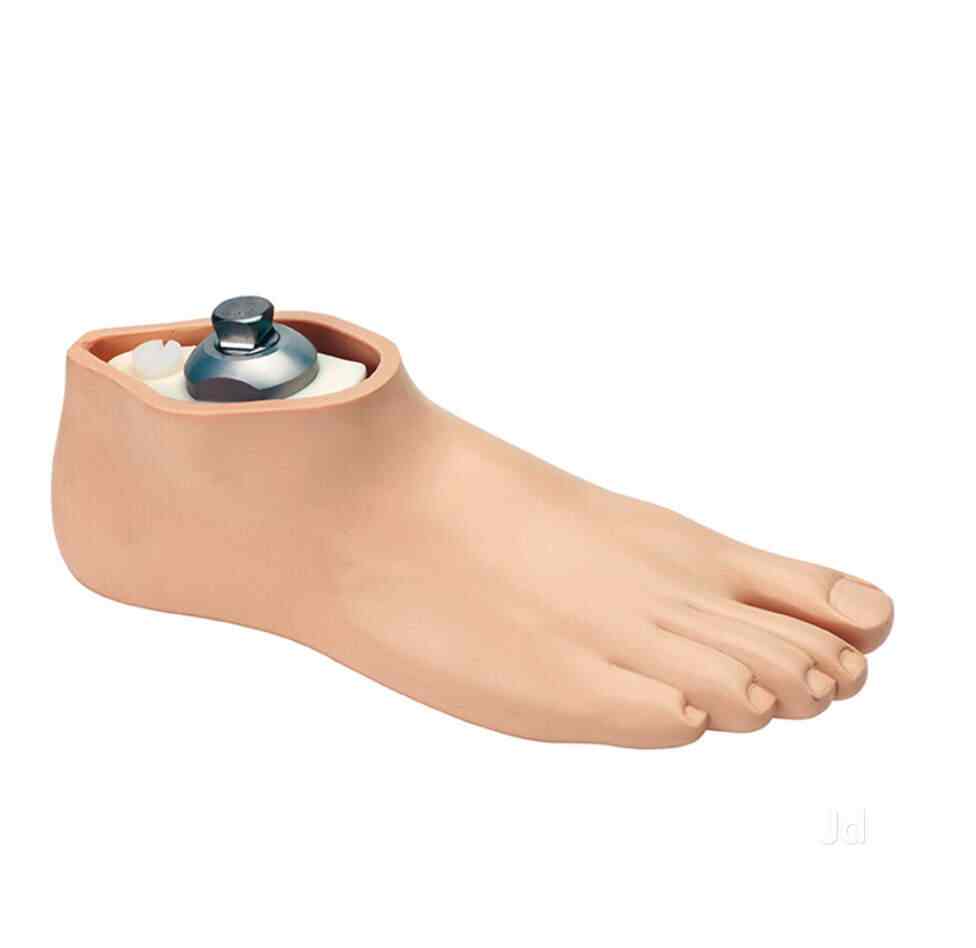 Endolite India LTD in Siripuram,Visakhapatnam - Best Artificial Limb  Manufacturers in Visakhapatnam - Justdial