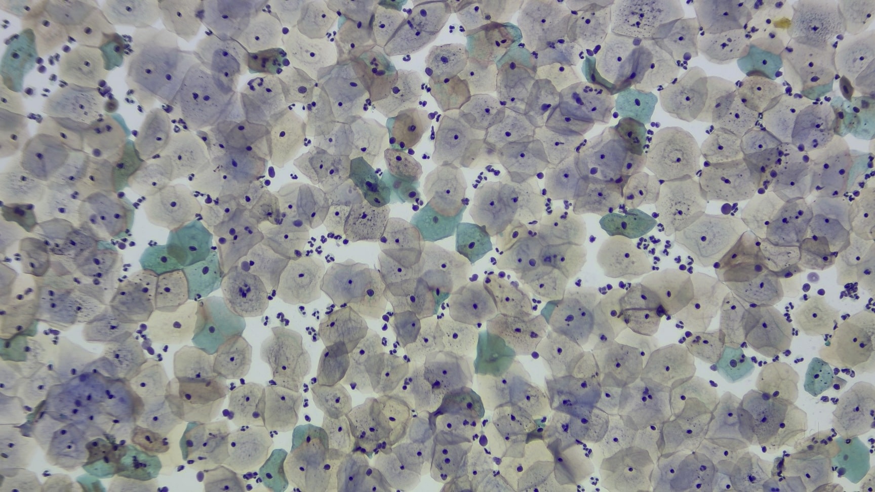 Lab view 6