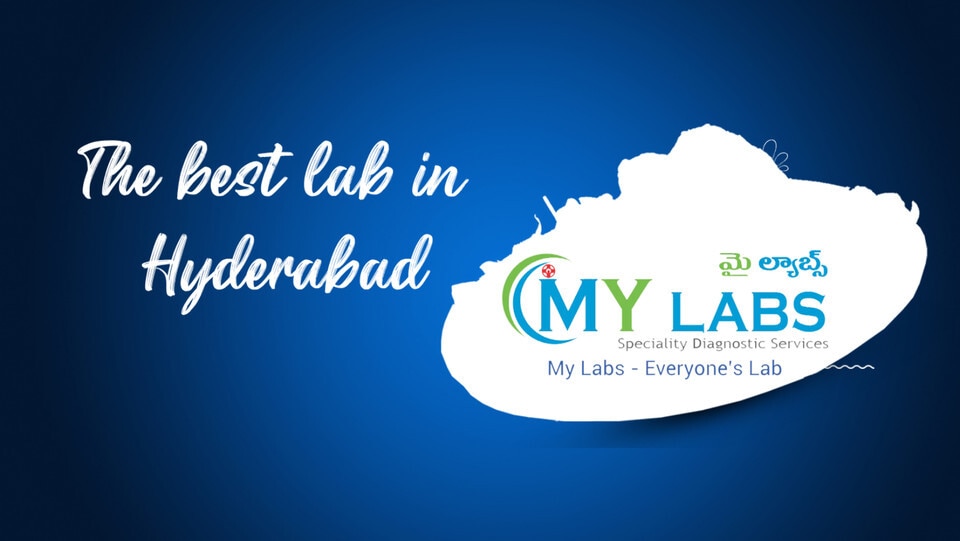 Lab view 12