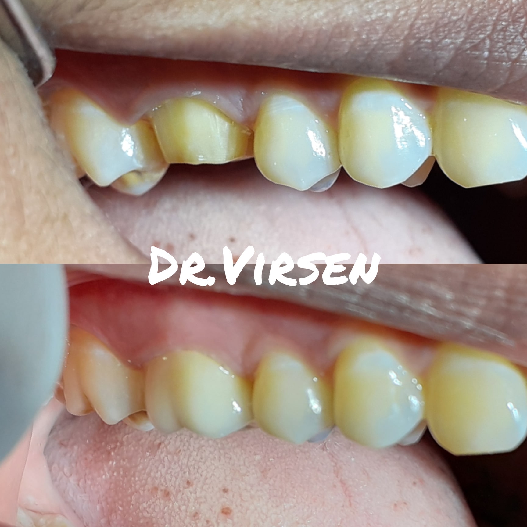 Smile City-multispeciality Dental Clinic And Implant Center in