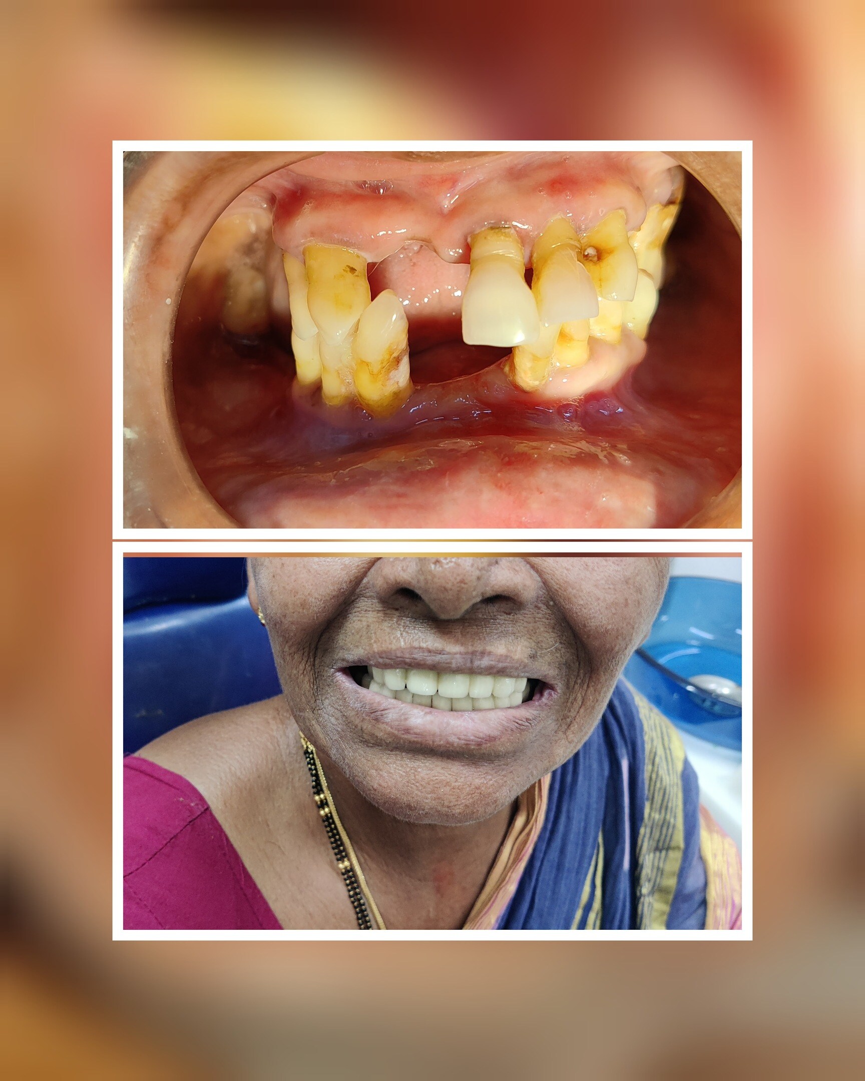 smile-dental-and-implant-